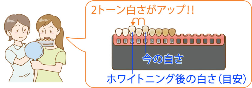 今の白さから2トーン白さがアップします。ホワイトニング後の目安の白さがわかります