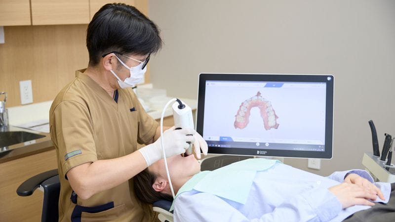 IOS（口腔内スキャナー）